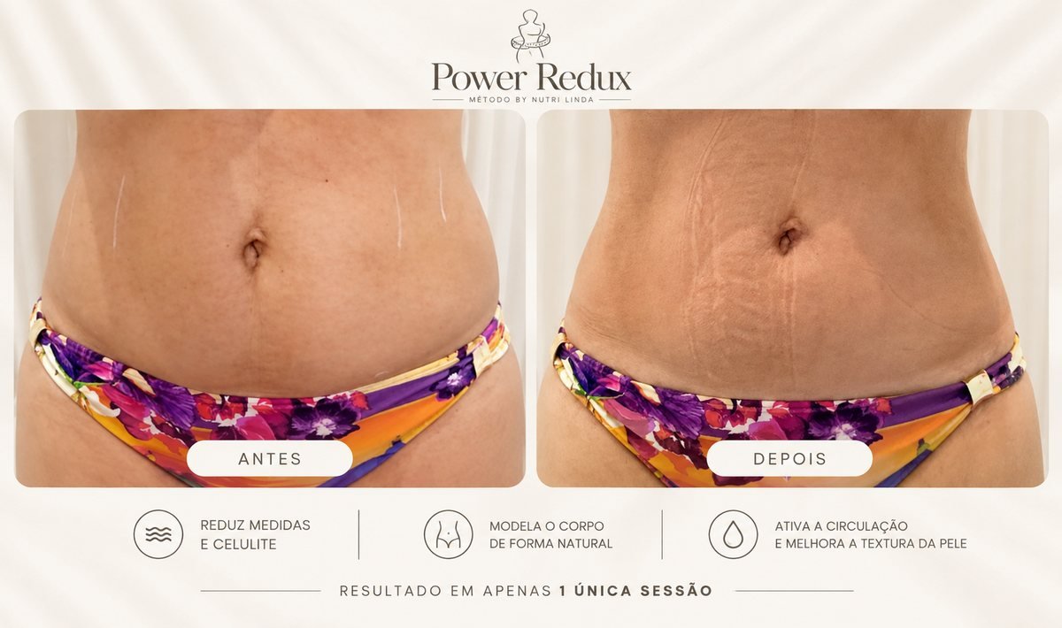 Antes e depois - Power Redux®
